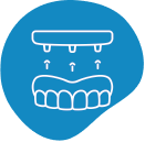 Clear Aligners Brisbane General Dentistry dental bridge