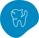 Toothache Cracked or Chipped Tooth