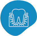 Toothache General Dentistrygum Disease