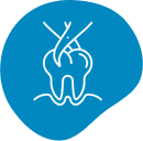 Toothache