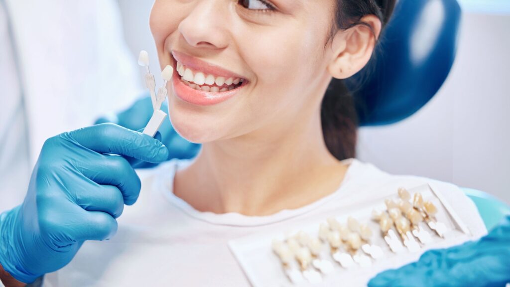 Dental Veneers