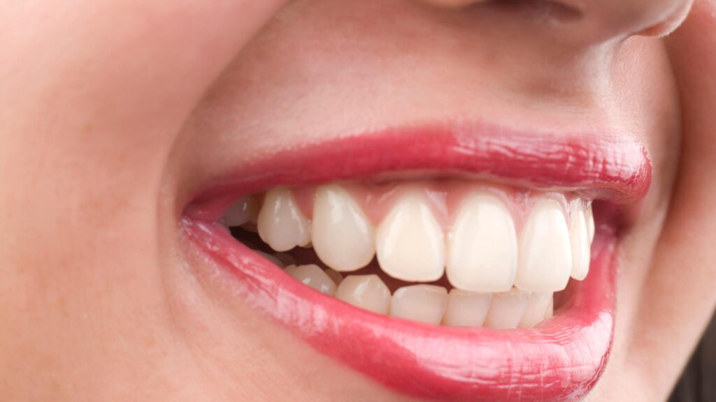 Oral Health